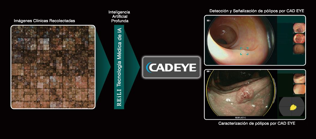 CAD EYE 1